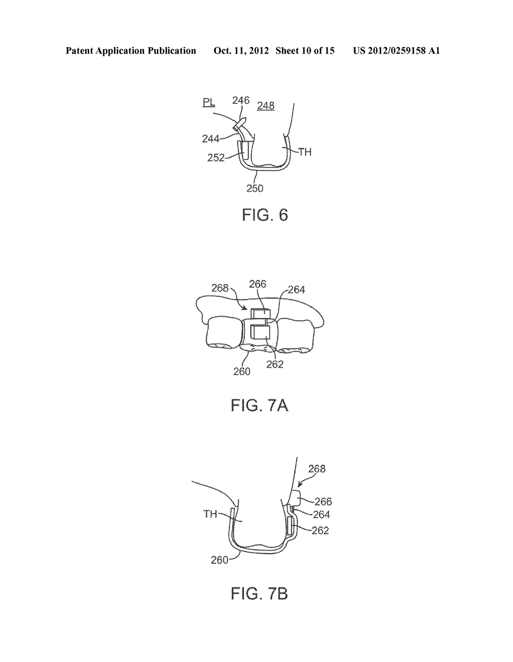 METHODS AND APPARATUS FOR TRANSMITTING VIBRATIONS - diagram, schematic, and image 11