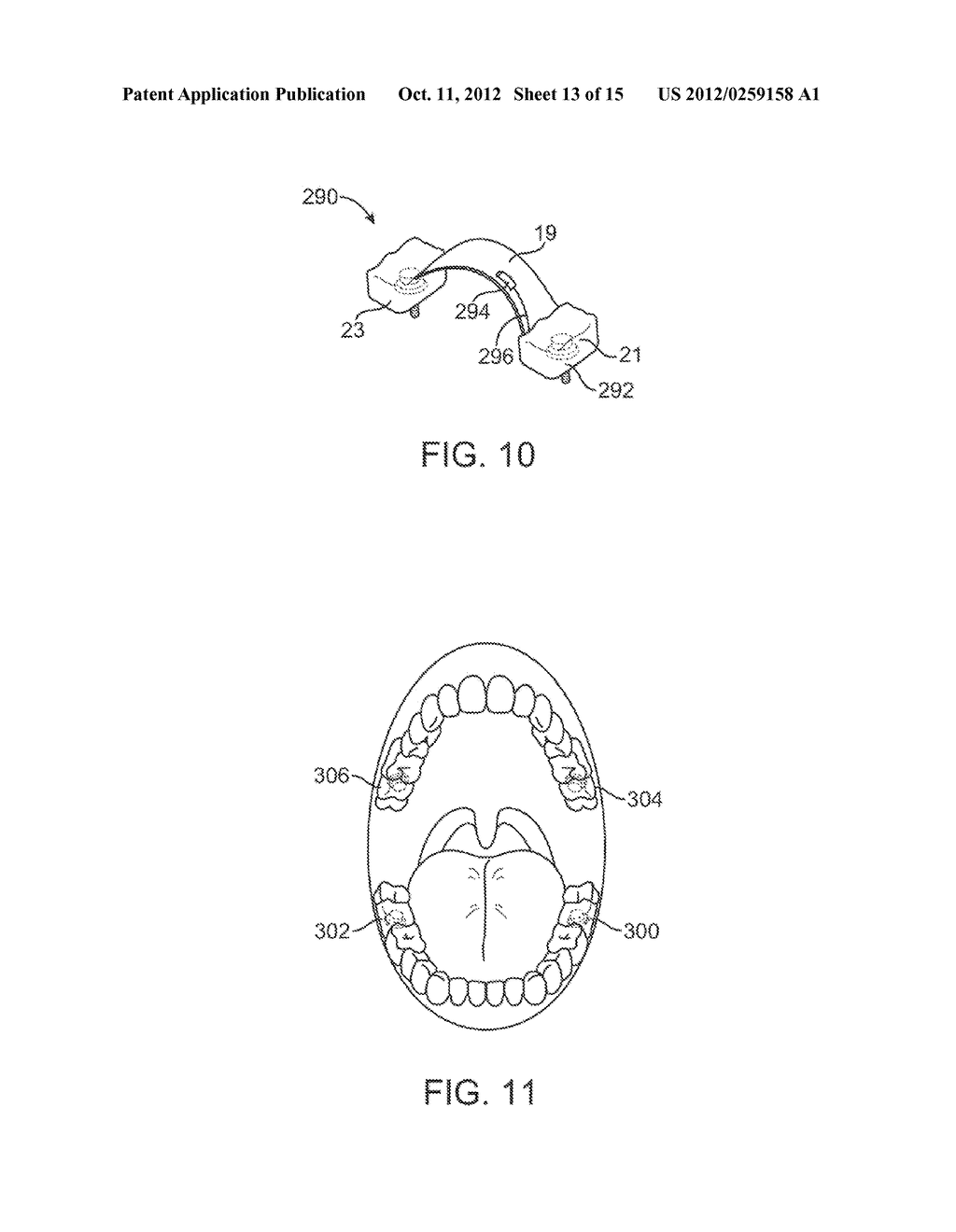METHODS AND APPARATUS FOR TRANSMITTING VIBRATIONS - diagram, schematic, and image 14