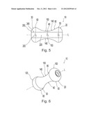 PESSARY DEVICE HAVING IMPROVED COMFORT diagram and image