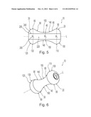 PESSARY DEVICE WITH LONGITUDINAL FLEXIBILITY diagram and image