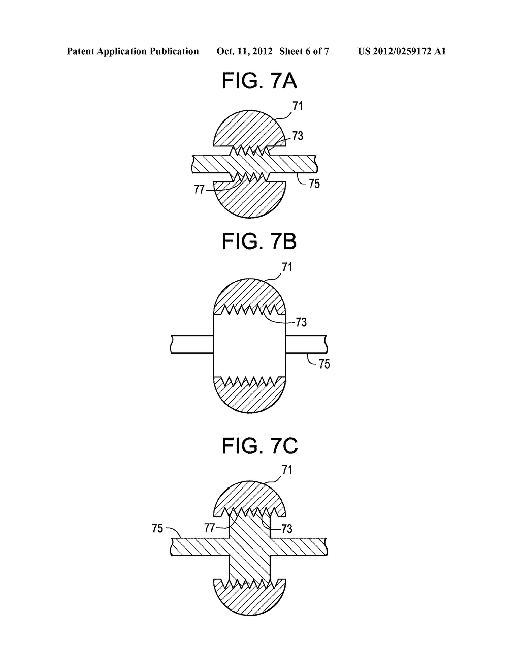 Instrument Adaptor for Image Guided Surgery - diagram, schematic, and image 07