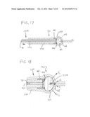 BALLOON ACCESS DEVICE FOR ENDOSCOPE diagram and image