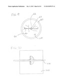 BALLOON ACCESS DEVICE FOR ENDOSCOPE diagram and image