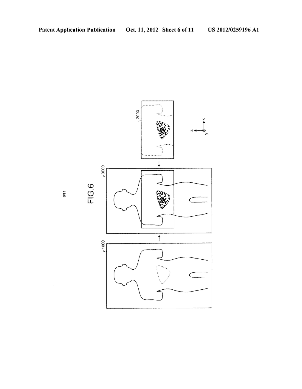 MEDICAL IMAGE DIAGNOSTIC APPARATUS AND CONTROL METHOD - diagram, schematic, and image 07