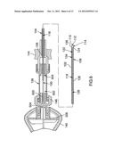 Method for Introducing Materials into a Body diagram and image