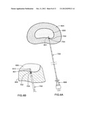 Method for Introducing Materials into a Body diagram and image