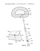 Method for Introducing Materials into a Body diagram and image