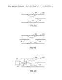 MICROCATHETER WITH DISTAL TIP PORTION AND PROXIMAL SOLUTION LUMEN diagram and image