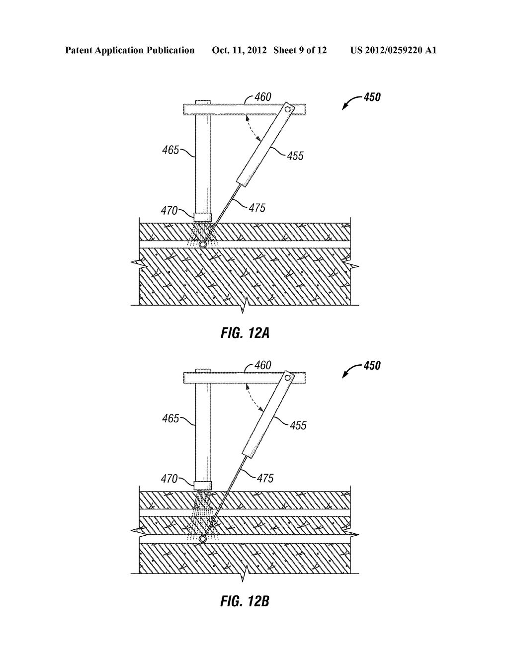 MOTORIZED SYSTEMS AND METHODS FOR ACCESSING THE LUMEN OF A VESSEL - diagram, schematic, and image 10