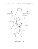 NEUROPHYSIOLOGICAL STIMULATION SYSTEM AND METHODS WITH WIRELESS     COMMUNICATION diagram and image