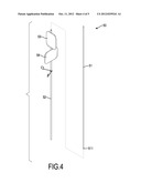 DUAL-WINGS PERCUTANEOUS NEEDLE diagram and image