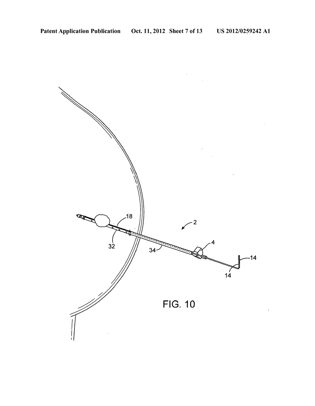 DEVICES AND METHODS FOR PERFORMING PROCEDURES ON A BREAST - diagram, schematic, and image 08