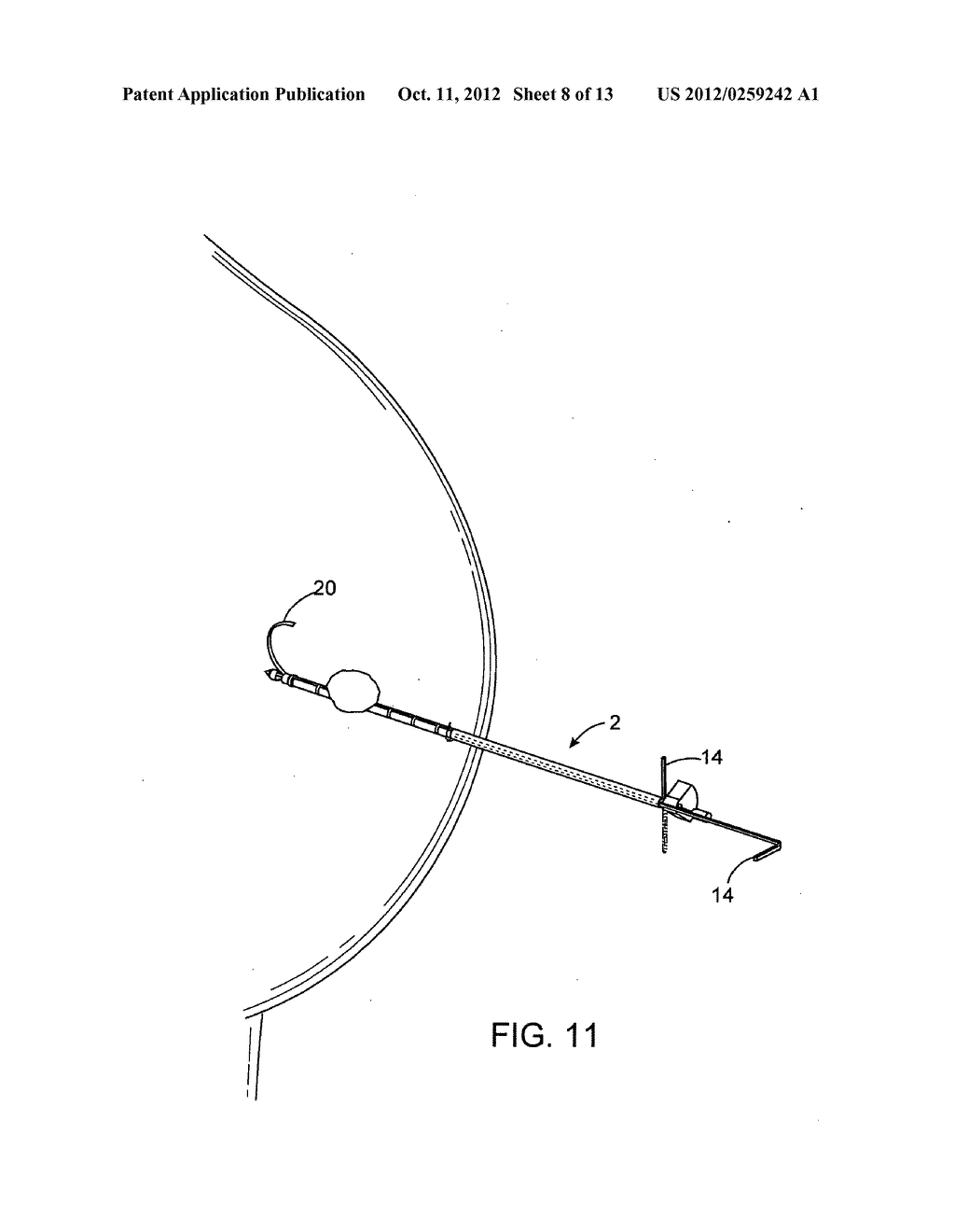 DEVICES AND METHODS FOR PERFORMING PROCEDURES ON A BREAST - diagram, schematic, and image 09