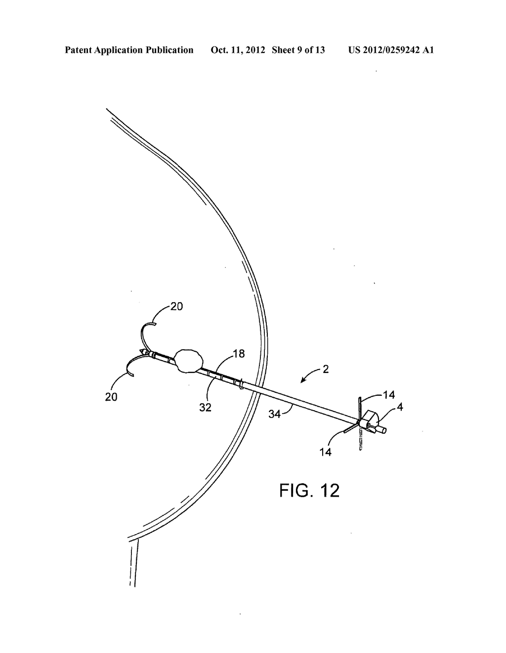 DEVICES AND METHODS FOR PERFORMING PROCEDURES ON A BREAST - diagram, schematic, and image 10