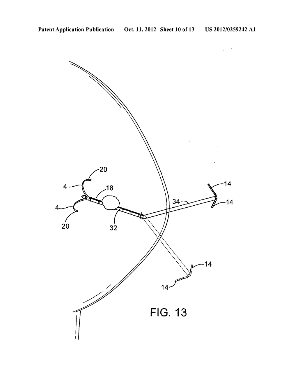 DEVICES AND METHODS FOR PERFORMING PROCEDURES ON A BREAST - diagram, schematic, and image 11