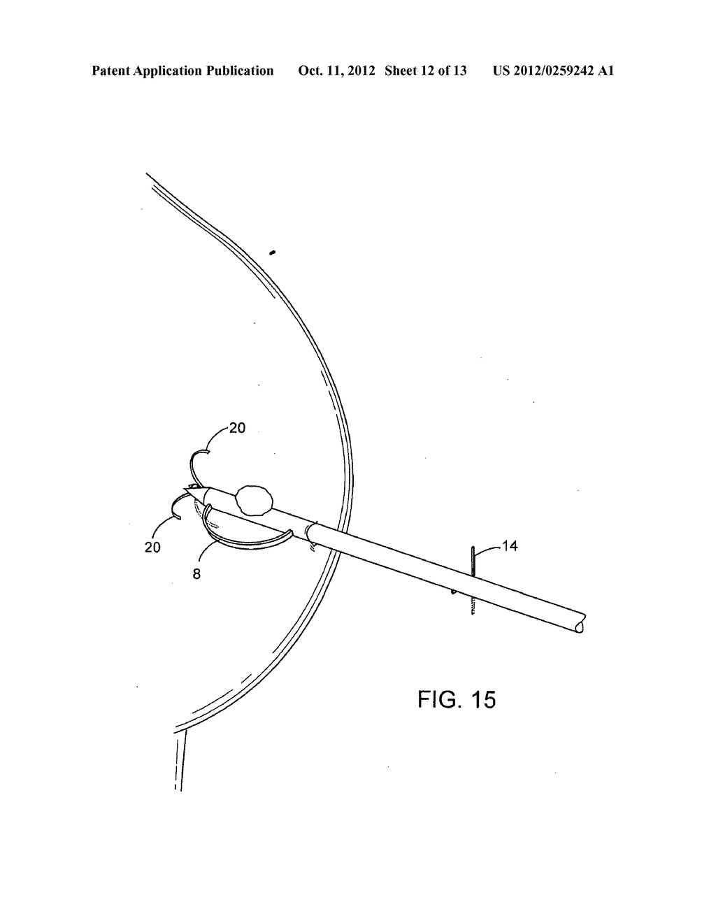 DEVICES AND METHODS FOR PERFORMING PROCEDURES ON A BREAST - diagram, schematic, and image 13