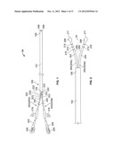 Catheter Systems and Methods of Use diagram and image
