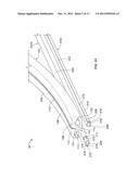 Catheter Systems and Methods of Use diagram and image