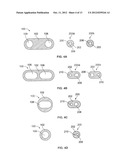 Catheter Systems and Methods of Use diagram and image