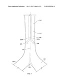 Catheter Systems and Methods of Use diagram and image