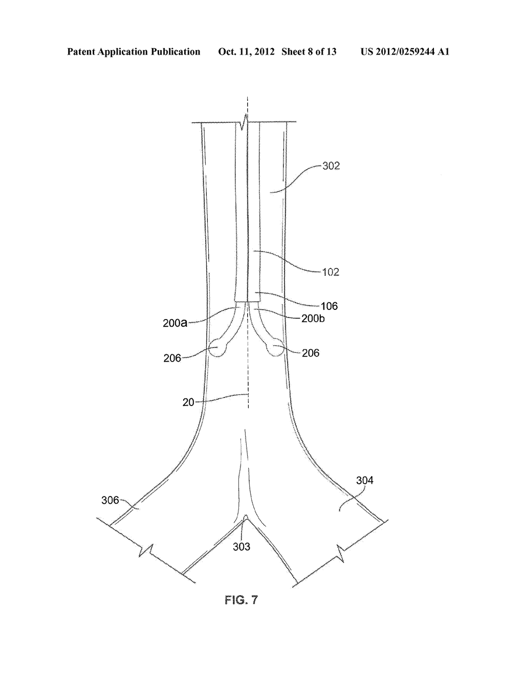 Catheter Systems and Methods of Use - diagram, schematic, and image 09