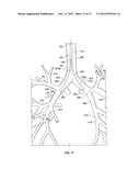 Catheter Systems and Methods of Use diagram and image