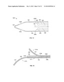 Catheter Systems and Methods of Use diagram and image