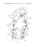 METHOD FOR CORRECTING PATHOLOGICAL CONFIGURATIONS OF SEGMENTS OF THE LOWER     EXTREMITIES AND DEVICE FOR REALIZING SAME diagram and image