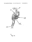 METHOD FOR CORRECTING PATHOLOGICAL CONFIGURATIONS OF SEGMENTS OF THE LOWER     EXTREMITIES AND DEVICE FOR REALIZING SAME diagram and image