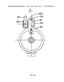 METHOD FOR CORRECTING PATHOLOGICAL CONFIGURATIONS OF SEGMENTS OF THE LOWER     EXTREMITIES AND DEVICE FOR REALIZING SAME diagram and image