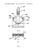 METHOD FOR CORRECTING PATHOLOGICAL CONFIGURATIONS OF SEGMENTS OF THE LOWER     EXTREMITIES AND DEVICE FOR REALIZING SAME diagram and image