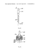 METHOD FOR CORRECTING PATHOLOGICAL CONFIGURATIONS OF SEGMENTS OF THE LOWER     EXTREMITIES AND DEVICE FOR REALIZING SAME diagram and image