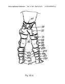 METHOD FOR CORRECTING PATHOLOGICAL CONFIGURATIONS OF SEGMENTS OF THE LOWER     EXTREMITIES AND DEVICE FOR REALIZING SAME diagram and image