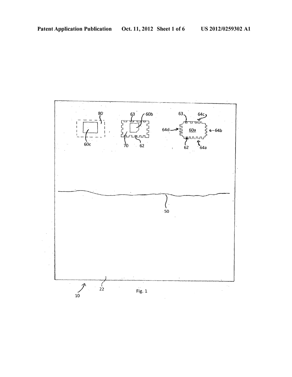 SURGICAL PRODUCT - diagram, schematic, and image 02