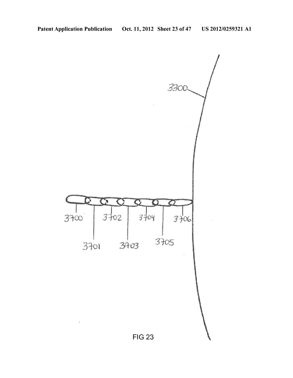 Systems and methods to deliver photodisruptive laser pulses into tissue     layers of the anterior angle of the eye - diagram, schematic, and image 24