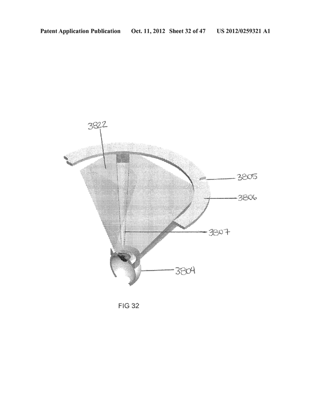 Systems and methods to deliver photodisruptive laser pulses into tissue     layers of the anterior angle of the eye - diagram, schematic, and image 33