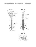 EXPANDING TRIAL STEM FOR ORTHOPAEDIC SURGERY diagram and image