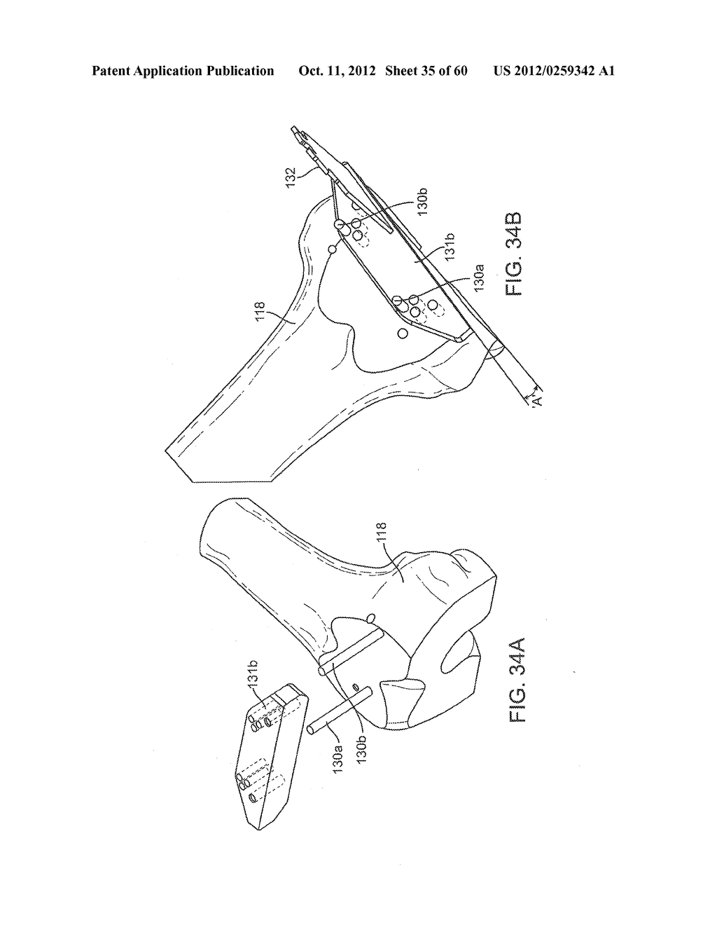 SYSTEM FOR POSITIONING A CUTTING GUIDE IN KNEE SURGERY - diagram, schematic, and image 36