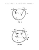 IN VIVO ACCESORIES FOR MINIMALLY INVASIVE ROBOTIC SURGERY diagram and image