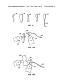 IN VIVO ACCESORIES FOR MINIMALLY INVASIVE ROBOTIC SURGERY diagram and image