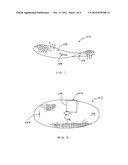 REINFORCEMENT DEVICE WITH DISSOLVABLE LAYER AND ITS USE diagram and image