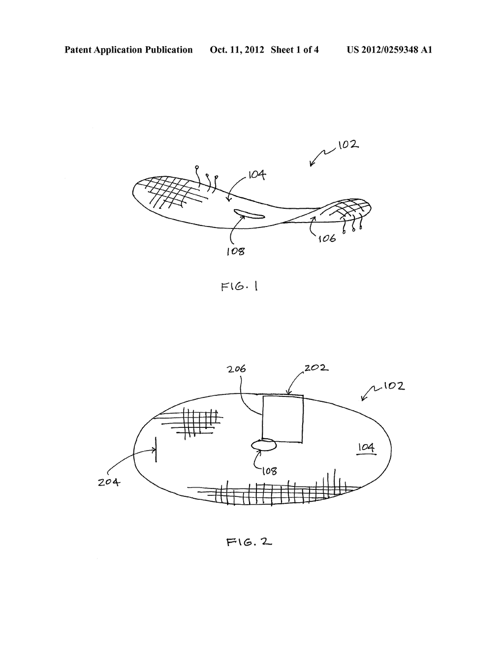 REINFORCEMENT DEVICE WITH DISSOLVABLE LAYER AND ITS USE - diagram, schematic, and image 02