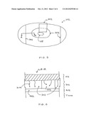 REINFORCEMENT DEVICE WITH DISSOLVABLE LAYER AND ITS USE diagram and image