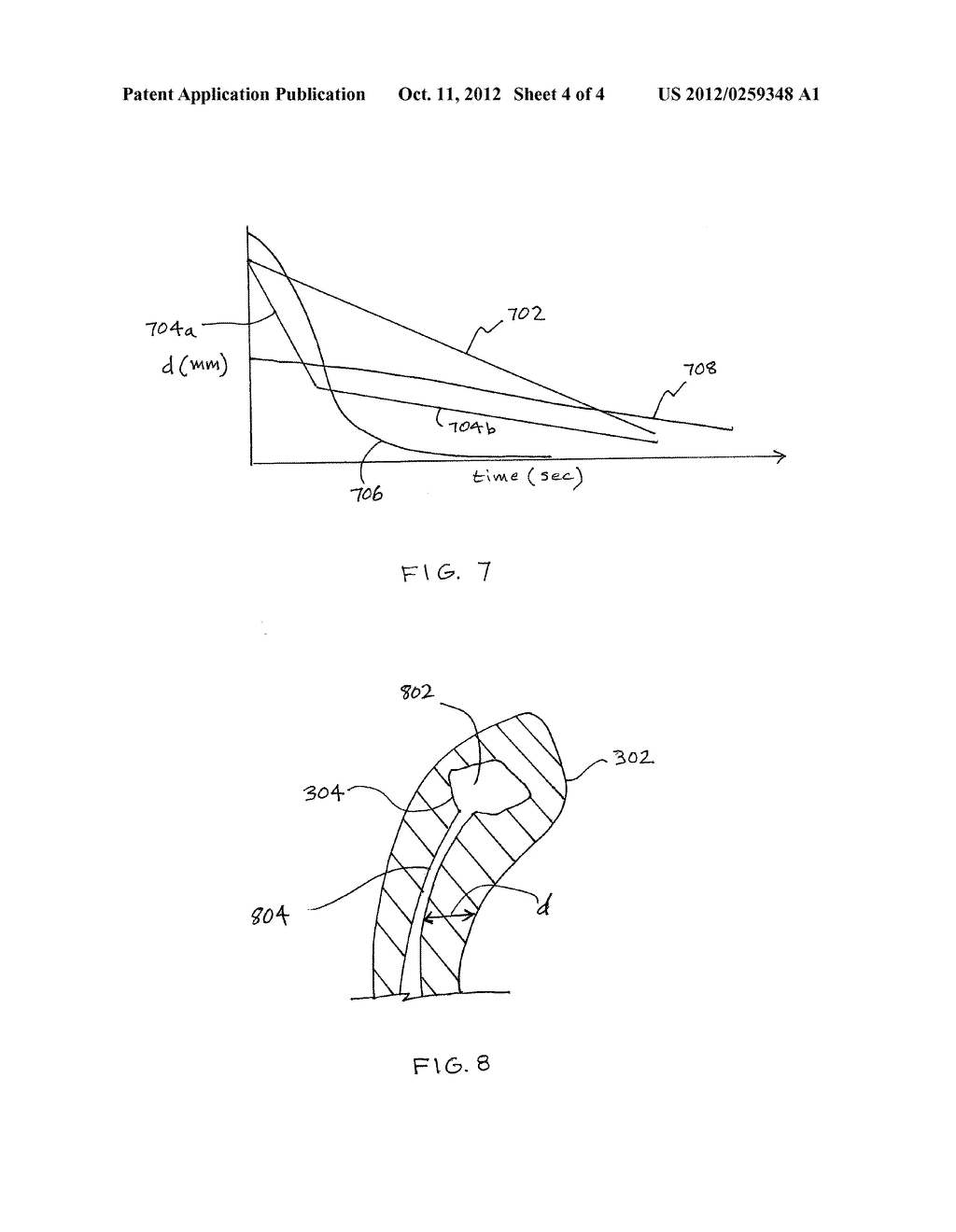 REINFORCEMENT DEVICE WITH DISSOLVABLE LAYER AND ITS USE - diagram, schematic, and image 05