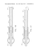 SURGICAL INSTRUMENTS diagram and image