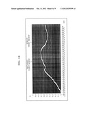 SUTURE NEEDLE diagram and image