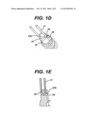 SUTURE ANCHOR WITH IMPROVED TORSIONAL DRIVE HEAD diagram and image