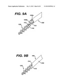 SUTURE ANCHOR WITH IMPROVED TORSIONAL DRIVE HEAD diagram and image