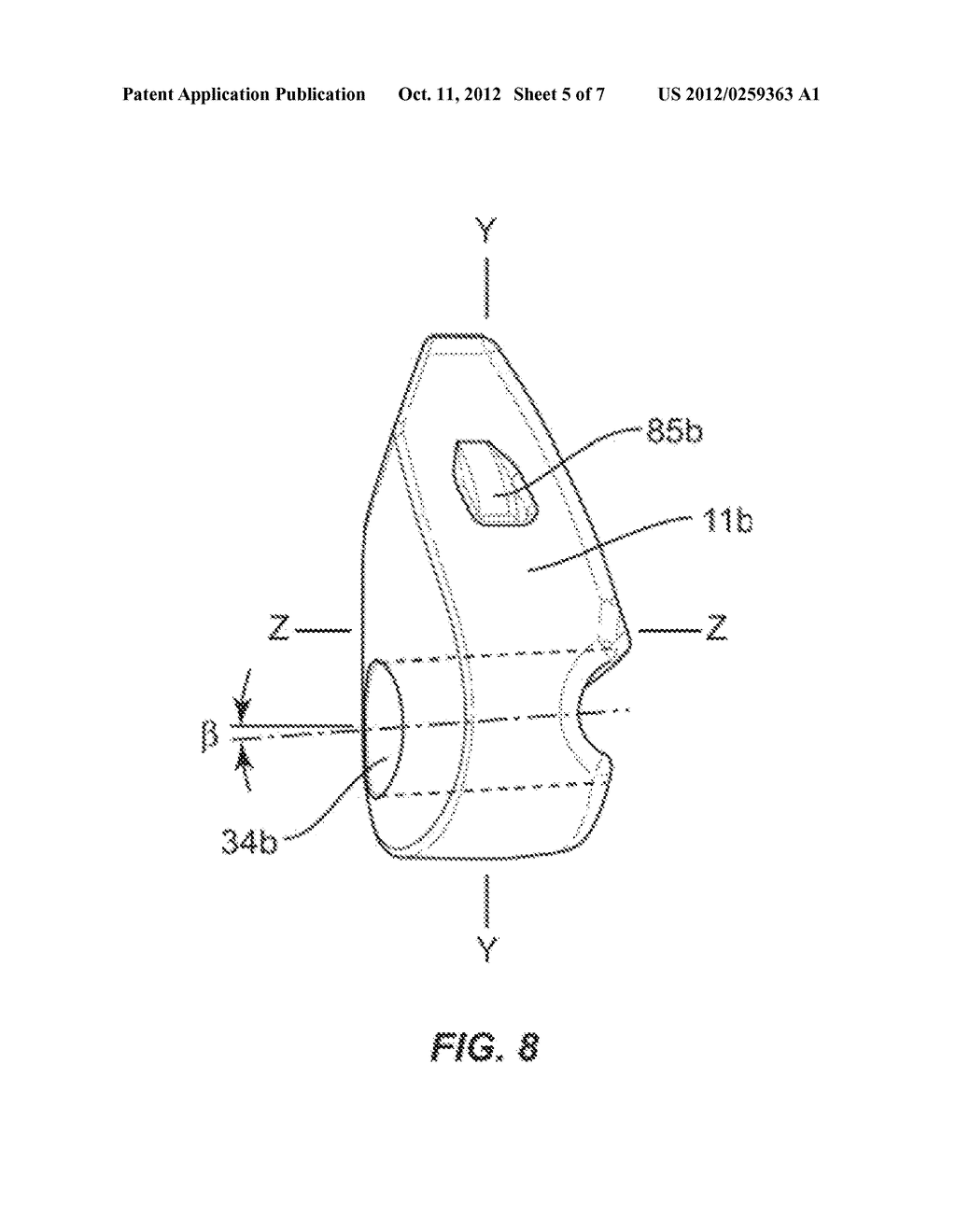 VISCOELASTIC LUMBAR-SACRAL IMPLANT - diagram, schematic, and image 06