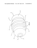 FACET FUSION IMPLANT, INSTRUMENTATION, AND SURGICAL PROCEDURE diagram and image